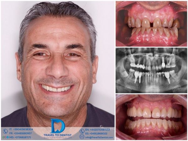 Caso 2 — Resultado de tratamiento dental